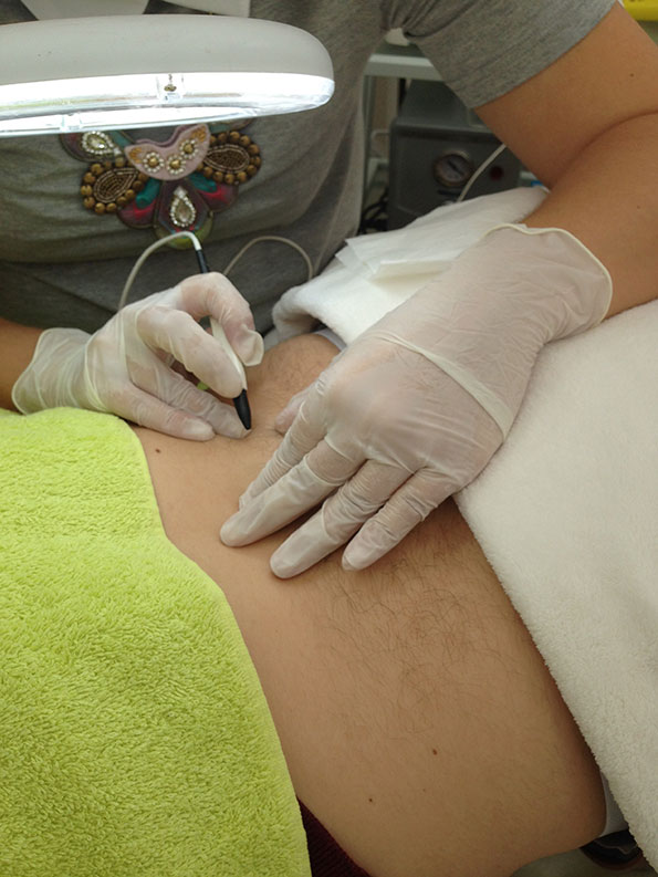 Electrolysis